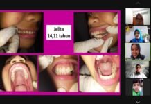 FKG UI Sosialisasi Cara Perawatan Gigi Anak Berkebutuhan Khusus