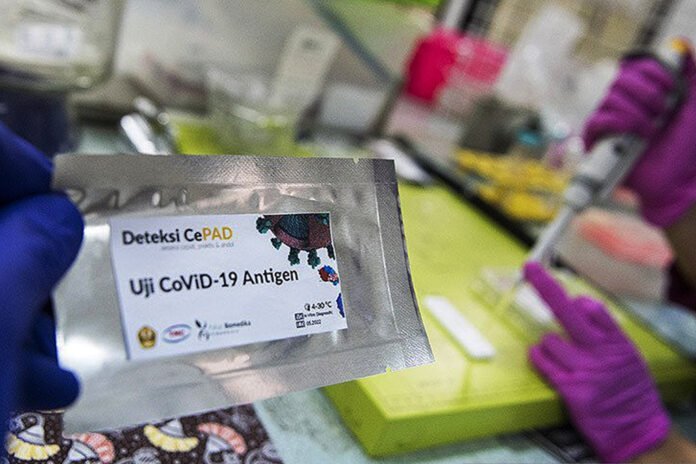 antarafoto-alat-rapid-test-cepad-210520-agr-1_1