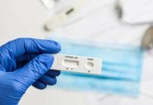 Alat Ukur Antibodi setelah Imunisasi COVID-19 Harus Aman