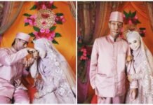 Bukti Cinta, Surya Manurung Pengidap Treacher Collins Syndrome Nikahi Gadis Cantik