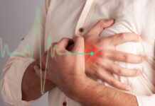 Dr Fatcha Nuraliah Beberkan Cara Sehat Merawat Jantung dan Penyakit Kronis