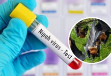 Virus Nipah Melonjak di India, Kemenkes Rilis Peringatan Dini Ilustrasi Pengambilan sampel laboratorium dalam penanganan virus Nipah. Foto: Istimewa.